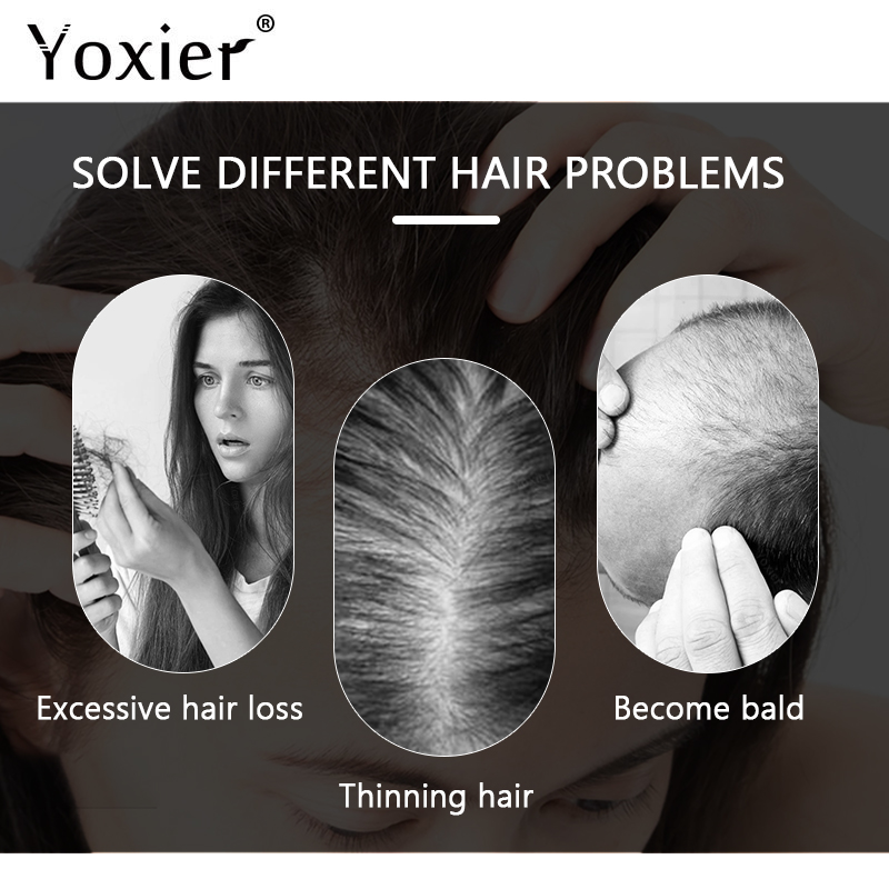 سيروم نمو مكثف يمنع تساقط الشع - مراجعة Hair Care Hair Serum وسعره