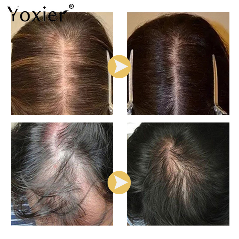 سيروم نمو مكثف يمنع تساقط الشع - مراجعة Hair Care Hair Serum وسعره