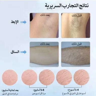 MLAY Factory T4 IPL الشعر المح - مراجعة Hair Care Homemade وسعره