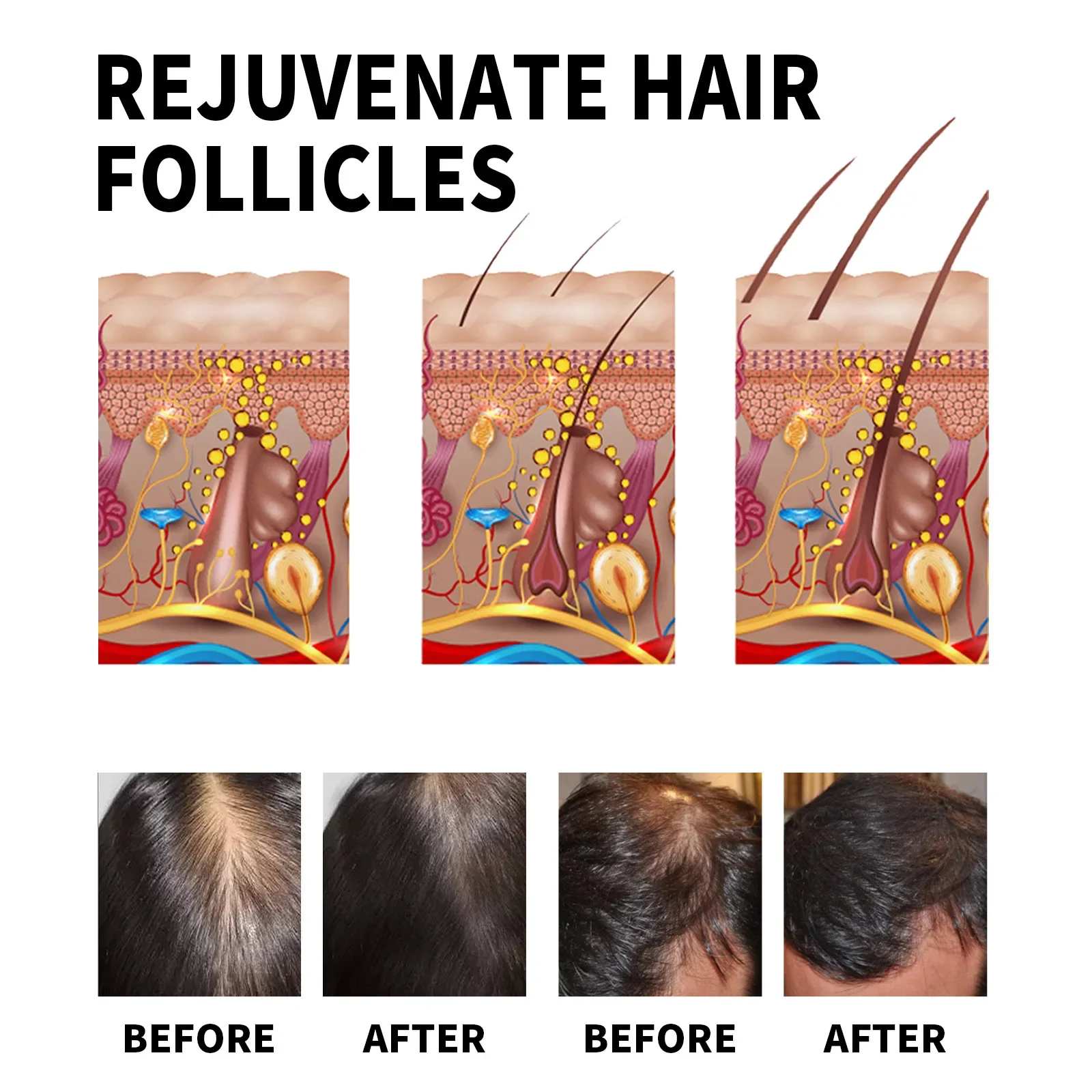منتجات نمو الشعر بالزنجبيل، زي - مراجعة Hair Care For Dry And Frizzy Hair وسعره