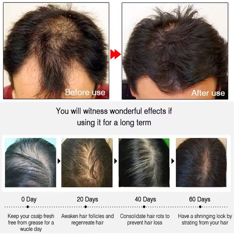 بخاخ الزنجبيل السريع لنمو الشع - مراجعة Hair Care Hair Serum وسعره
